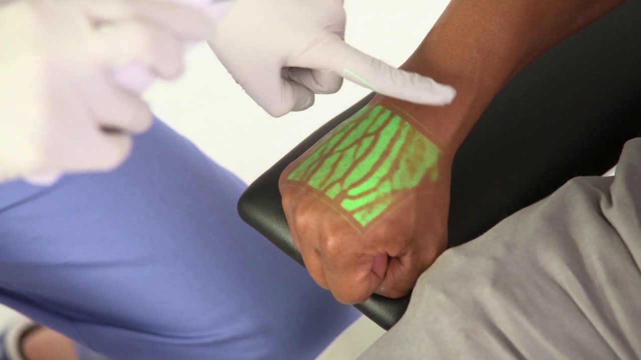 What is the AccuVein AV500?