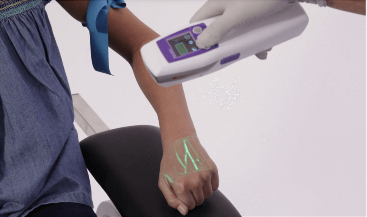 AccuVein_reverse AccuVein AV500 in use for vein visualization in inverse mode